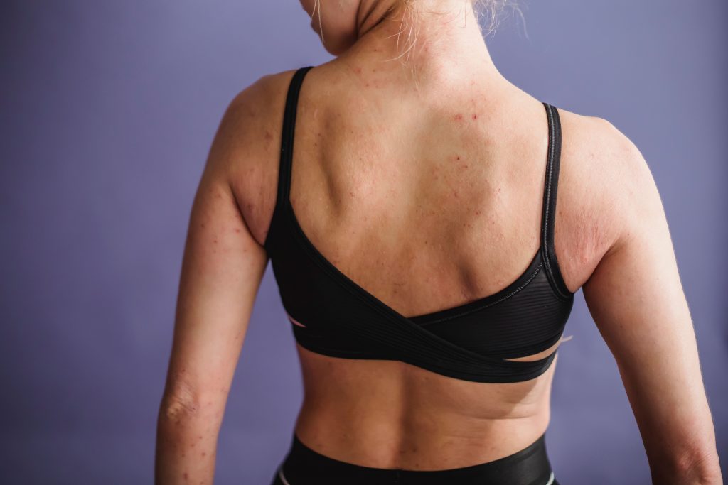 A back view of a woman's body from the waist up to the neck. The woman is wearing a black bra and pants, and the image shows her looking over her shoulder.
