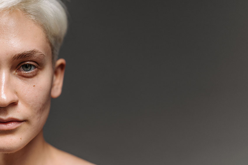 Half a face is showing on the left hand side of the image with a grey background. The person has short blonde hair, is looking directly at the camera.